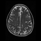 My Brain. Brain MRI Pictures.