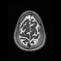 My Brain. Brain MRI Pictures.