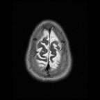 My Brain. Brain MRI Pictures.