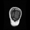 My Brain. Brain MRI Pictures.