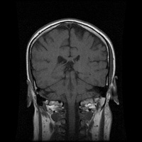 My Brain. Brain MRI Pictures.