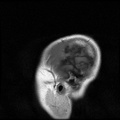 My Brain. Brain MRI Pictures.