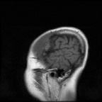 My Brain. Brain MRI Pictures.