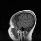 My Brain. Brain MRI Pictures.