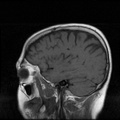 My Brain. Brain MRI Pictures.