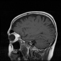 My Brain. Brain MRI Pictures.