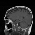 My Brain. Brain MRI Pictures.