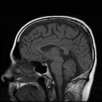 My Brain. Brain MRI Pictures.