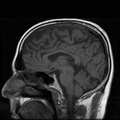 My Brain. Brain MRI Pictures.