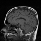 My Brain. Brain MRI Pictures.