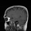 My Brain. Brain MRI Pictures.