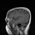 My Brain. Brain MRI Pictures.