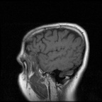 My Brain. Brain MRI Pictures.