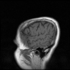 My Brain. Brain MRI Pictures.