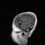 My Brain. Brain MRI Pictures.