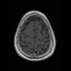 My Brain. Brain MRI Pictures.