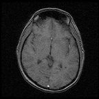 My Brain. Brain MRI Pictures.