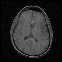 My Brain. Brain MRI Pictures.
