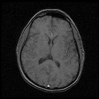 My Brain. Brain MRI Pictures.