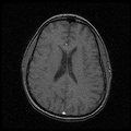 My Brain. Brain MRI Pictures.