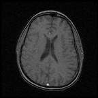 My Brain. Brain MRI Pictures.