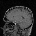 My Brain. Brain MRI Pictures.