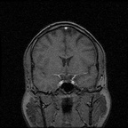 My Brain. Brain MRI Pictures.