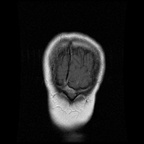 My Brain. Brain MRI Pictures.