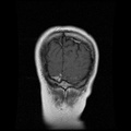 My Brain. Brain MRI Pictures.