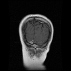 My Brain. Brain MRI Pictures.