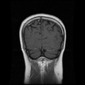 My Brain. Brain MRI Pictures.