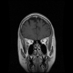 My Brain. Brain MRI Pictures.