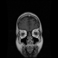 My Brain. Brain MRI Pictures.