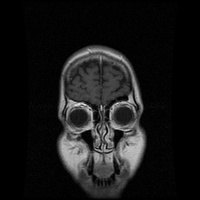 My Brain. Brain MRI Pictures.
