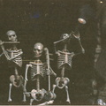 Band of Bones