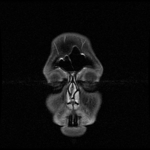 My Brain. Brain MRI Pictures.