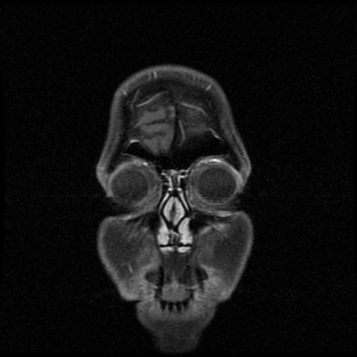 My Brain. Brain MRI Pictures.