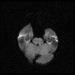 My Brain. Brain MRI Pictures.