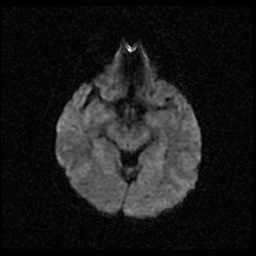 My Brain. Brain MRI Pictures.