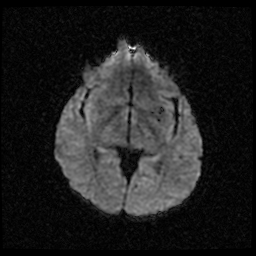 My Brain. Brain MRI Pictures.