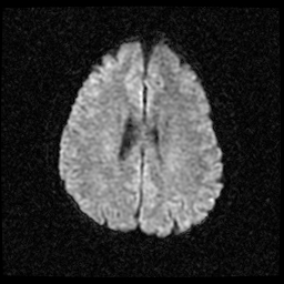 My Brain. Brain MRI Pictures.