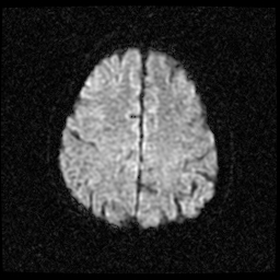 My Brain. Brain MRI Pictures.