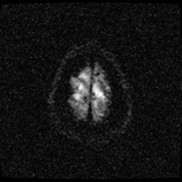 My Brain. Brain MRI Pictures.