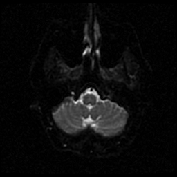 My Brain. Brain MRI Pictures.