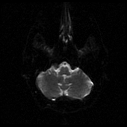 My Brain. Brain MRI Pictures.