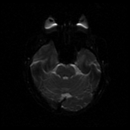 My Brain. Brain MRI Pictures.