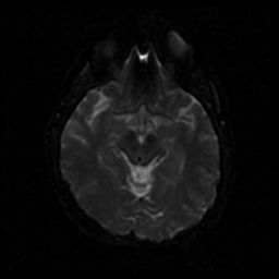 My Brain. Brain MRI Pictures.