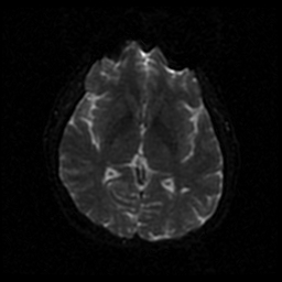 My Brain. Brain MRI Pictures.