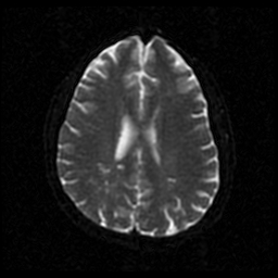 My Brain. Brain MRI Pictures.