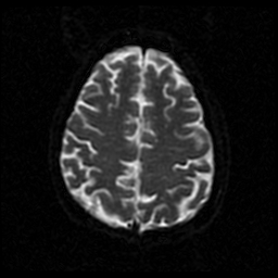 My Brain. Brain MRI Pictures.